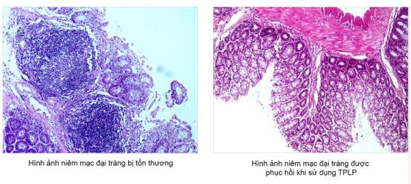 Tràng Phục Linh PLUS - Đột phá mới hỗ trợ điều trị viêm đại tràng co thắt của người Việt - Ảnh 3.