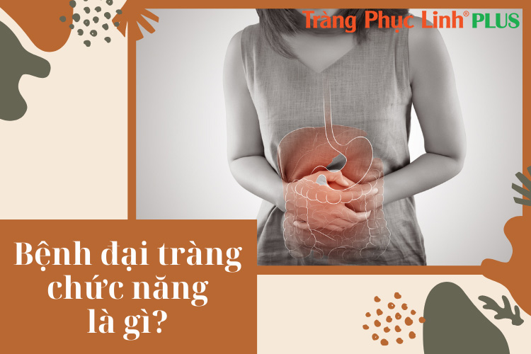 Bệnh đại tràng chức năng là gì? Nguyên nhân và cách điều trị