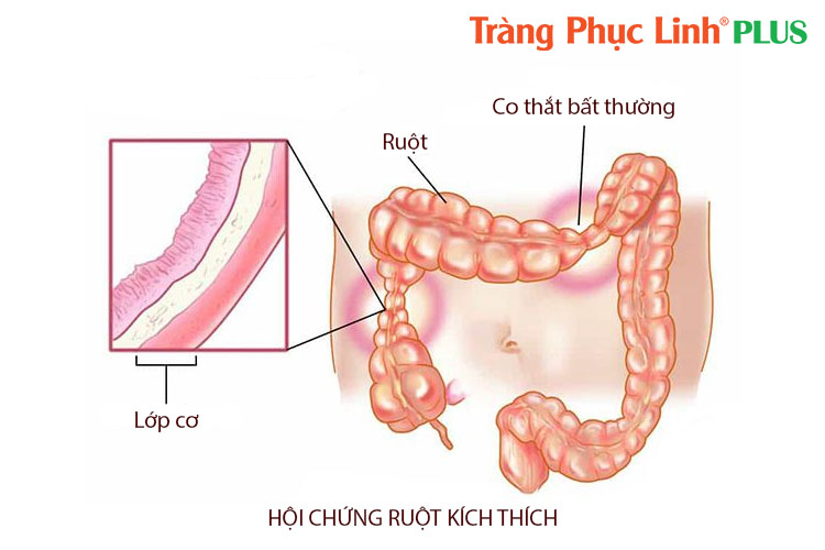 hoi-chung-ruot-kich-thich