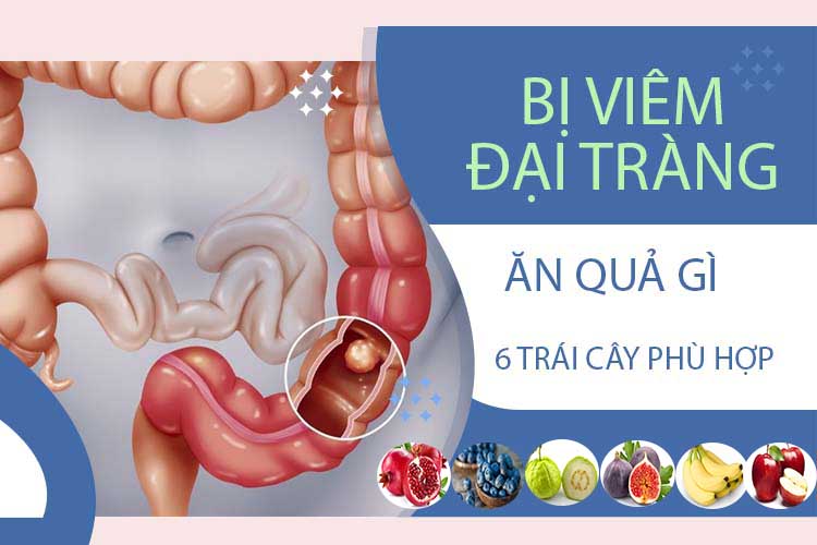 6 loại trái cây tốt cho người bị viêm đại tràng