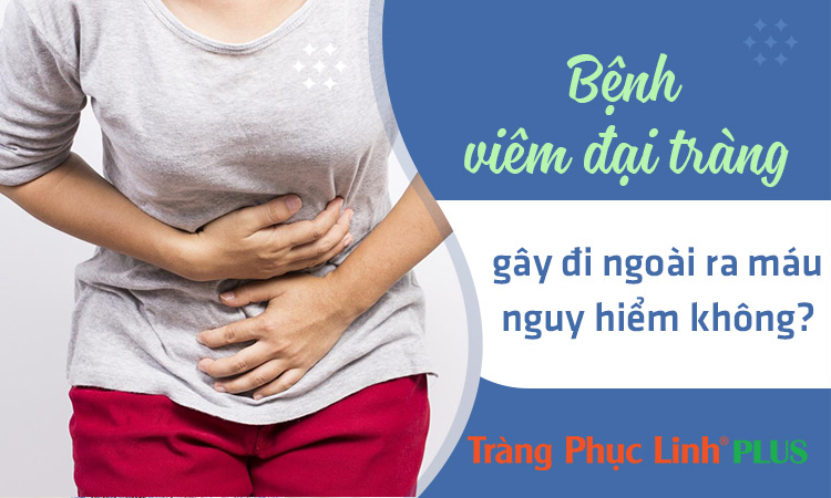 [Đừng chủ quan] viêm đại tràng đi ngoài ra máu