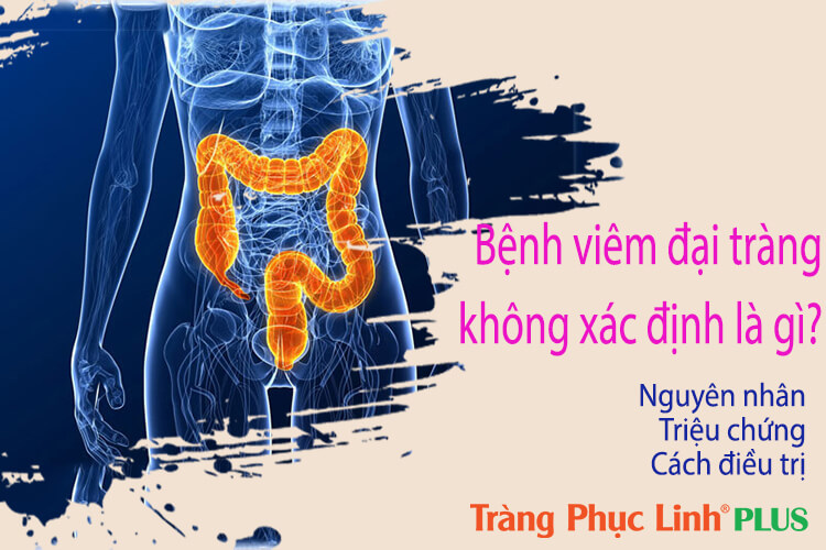 Viêm đại tràng không xác định: chẩn đoán và điều trị