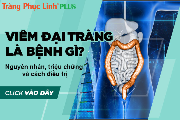 Viêm đại tràng - Nguyên nhân, triệu chứng và cách điều trị