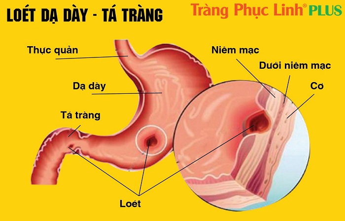 loet da day ta trang